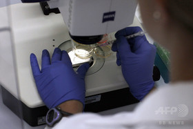 遺伝子操作細胞で英1歳女児の白血病を治療、世界初 遺伝子操作細胞で英1歳女児の白血病を治療、世界初