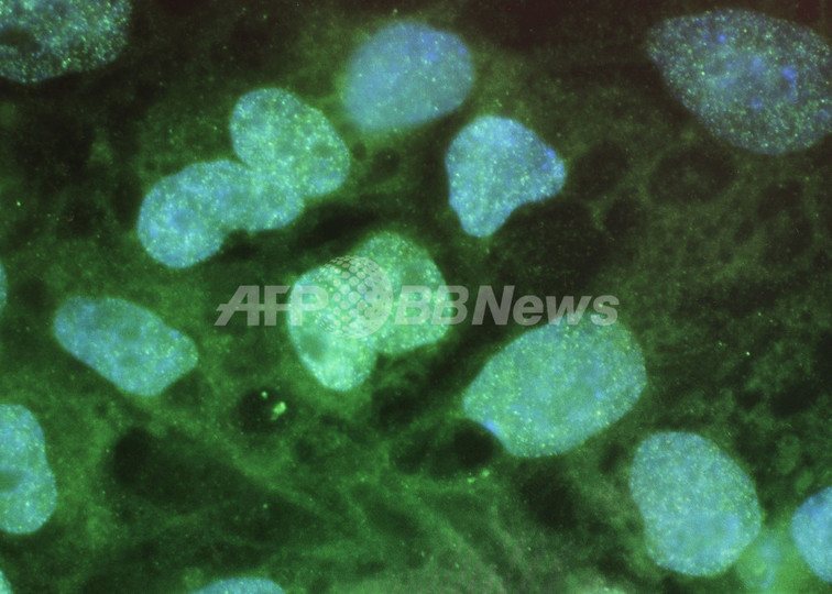 がんを再発させる「がん幹細胞」、3つの研究で発見 がんを再発させる「がん幹細胞」、3つの研究で発見