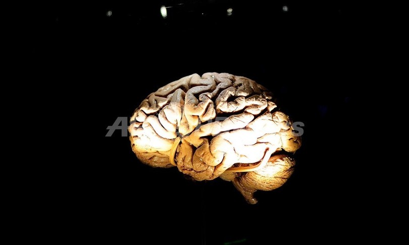遺伝子型「ApoE4」、アルツハイマーとの相関は女性限定 米研究 遺伝子型「ApoE4」、アルツハイマーとの相関は女性限定 米研究