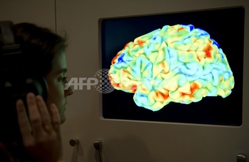 脳の3D透明化技術の開発に成功、米研究 脳の3D透明化技術の開発に成功、米研究