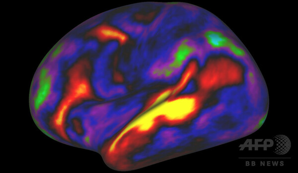 脳の「最も詳細な地図」作製、研究