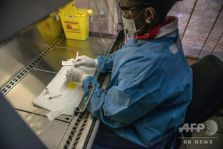 「世界初」HIV陽性の母から子に肝移植、経過良好 南ア 「世界初」HIV陽性の母から子に肝移植、経過良好 南ア
