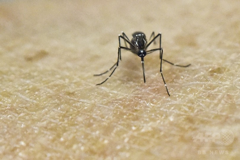 ジカウイルス、成人の脳感染症に関連か 仏研究 ジカウイルス、成人の脳感染症に関連か 仏研究
