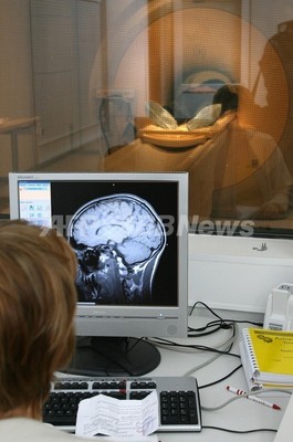 脳の活動阻害で道徳的判断に異常、米研究 脳の活動阻害で道徳的判断に異常、米研究