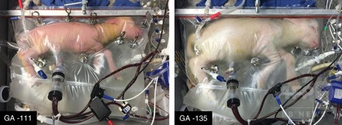 超未熟児向け人工子宮、ヒツジ胎児が正常発育 米研究 超未熟児向け人工子宮、ヒツジ胎児が正常発育 米研究