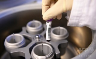 輸血で2200人超がHIV感染 インド 輸血で2200人超がHIV感染 インド