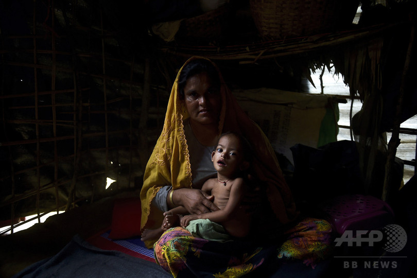 ロヒンギャ難民の子供、4分の1が栄養失調で命の危機 ユニセフ ロヒンギャ難民の子供、4分の1が栄養失調で命の危機 ユニセフ