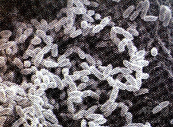 米研究所で危険な病原菌の漏出事故、当局が経緯を調査 米研究所で危険な病原菌の漏出事故、当局が経緯を調査