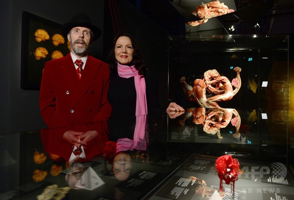 人体標本の博物館、ベルリンに開館 写真5枚 国際ニュース:AFPBB News 人体標本の博物館、ベルリンに開館 写真5枚 国際ニュース:AFPBB News