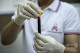 HIVの「隠れ家」を特定する目印発見、仏研究 HIVの「隠れ家」を特定する目印発見、仏研究