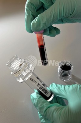 「妻も陽性ならセックスしてくれるはず」、睡眠中に針刺しHIV感染 「妻も陽性ならセックスしてくれるはず」、睡眠中に針刺しHIV感染
