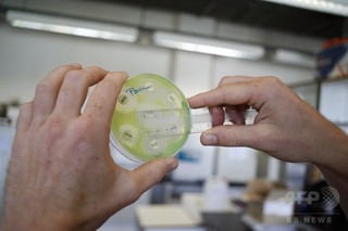 類鼻疽菌、通説より広範囲にまん延か 致死率70% 国際研究 類鼻疽菌、通説より広範囲にまん延か 致死率70% 国際研究