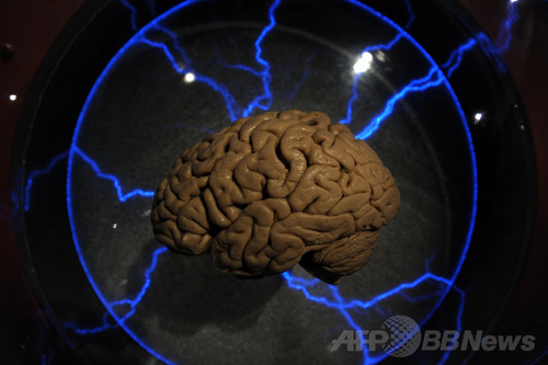 記憶を回復する脳インプラント、米軍研究が近日発表 記憶を回復する脳インプラント、米軍研究が近日発表