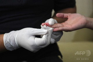 「結核」「HIV」「肥満」に関する国連目標、達成に世界的な遅れ 研究 「結核」「HIV」「肥満」に関する国連目標、達成に世界的な遅れ 研究