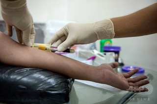 血中のHIV抗原、感染から1週間以内に検出可能に スペイン研究 血中のHIV抗原、感染から1週間以内に検出可能に スペイン研究