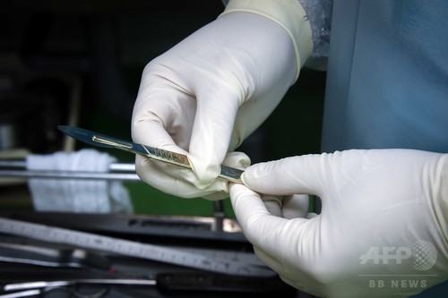 司法解剖率低い日本、犯罪死見逃す要因か 司法解剖率低い日本、犯罪死見逃す要因か