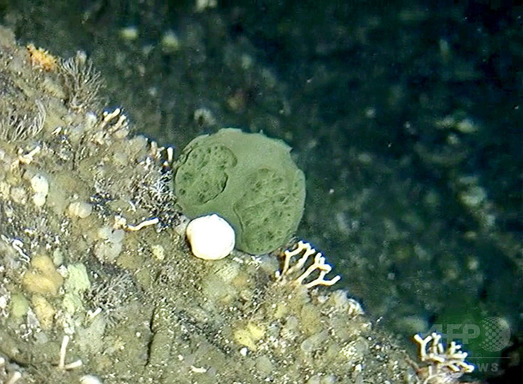 膵臓がんとの闘い、カギ握るのは「緑の海綿」か 米研究 膵臓がんとの闘い、カギ握るのは「緑の海綿」か 米研究