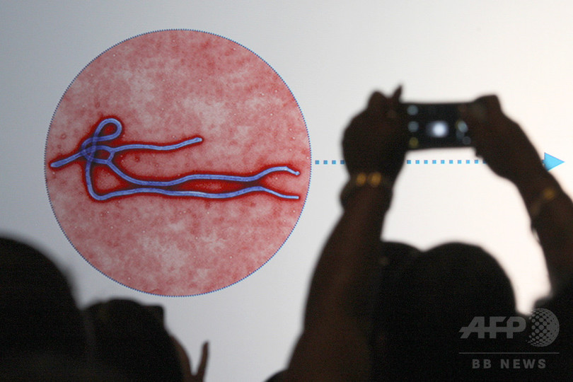 エボラ回復後に目からウイルス検出、初の事例を米国で確認 エボラ回復後に目からウイルス検出、初の事例を米国で確認