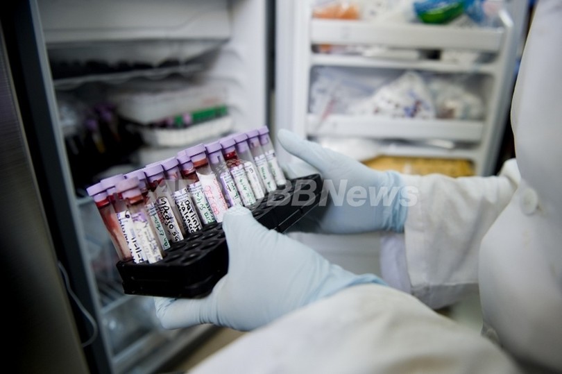 敗血症菌の臭い嗅ぎ分ける「人工鼻」を開発、台湾 敗血症菌の臭い嗅ぎ分ける「人工鼻」を開発、台湾