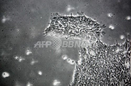 ヒトの皮膚細胞からES細胞の作製に成功、世界初 米大学チーム ヒトの皮膚細胞からES細胞の作製に成功、世界初 米大学チーム