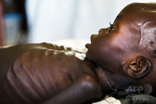 命綱は「木の葉」、南スーダン襲う食糧危機 貴重な貯蔵種子も食用に 命綱は「木の葉」、南スーダン襲う食糧危機 貴重な貯蔵種子も食用に