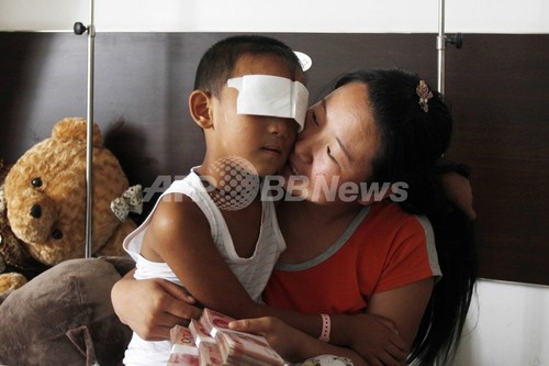 両目くりぬかれた男児、視力回復の可能性 眼科医が義眼無料移植申し出