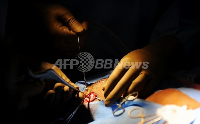 週末の手術、術後の死亡リスクが上昇 英研究 週末の手術、術後の死亡リスクが上昇 英研究