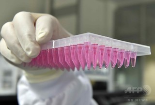 遺伝子編集でイヌの筋ジス改善、「治験への道開く」 国際研究 遺伝子編集でイヌの筋ジス改善、「治験への道開く」 国際研究