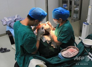 若はげ進み、養毛・植毛産業の勢い増す、中国 若はげ進み、養毛・植毛産業の勢い増す、中国