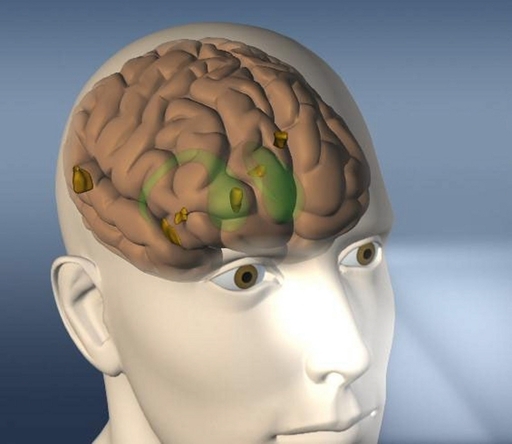 脳の動きで見ているものを当てる、脳解析で劇的な進歩 米研究報告