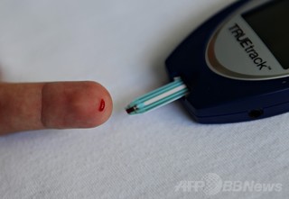 改良iPhoneで1型糖尿病の血糖値管理、米研究 改良iPhoneで1型糖尿病の血糖値管理、米研究