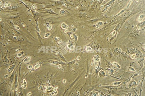 ES細胞から大量の赤血球を生成、輸血用血液の無限供給も可能か ES細胞から大量の赤血球を生成、輸血用血液の無限供給も可能か
