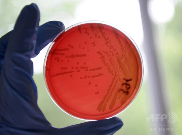 化学物質毒性をヒト細胞で予測、動物実験削減に期待 米研究 化学物質毒性をヒト細胞で予測、動物実験削減に期待 米研究