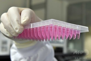 高精度「塩基エディター」、遺伝子治療の大きな一歩に 研究 高精度「塩基エディター」、遺伝子治療の大きな一歩に 研究