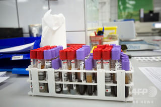 血液検査で体内時計を測定、米研究 血液検査で体内時計を測定、米研究