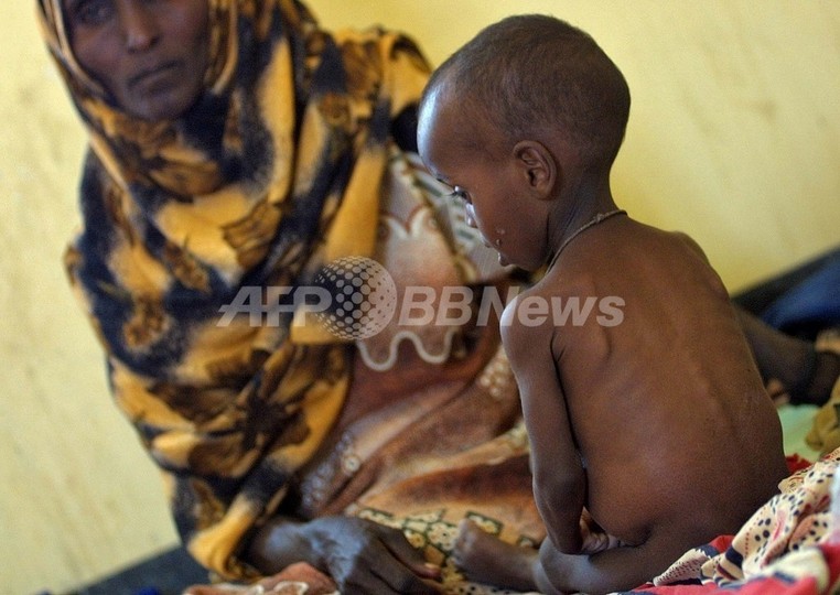 食料価格の高騰が貧困国の子どもを直撃、国境なき医師団 食料価格の高騰が貧困国の子どもを直撃、国境なき医師団