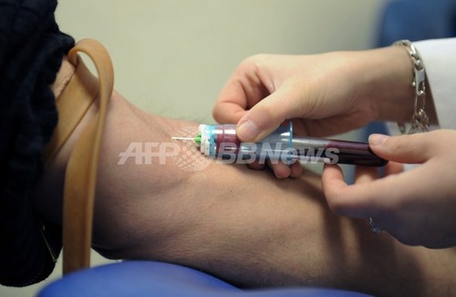 血液検査で「うつ状態」を判断、抗うつ剤の効果を素早く確認