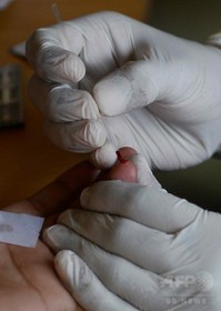 膵臓がん、早期発見可能な血液検査法を開発 米研究 膵臓がん、早期発見可能な血液検査法を開発 米研究