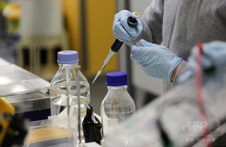 痛風治療薬、腸疾患の症状改善にも効果か 研究 痛風治療薬、腸疾患の症状改善にも効果か 研究