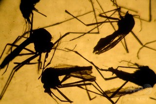 ジカウイルス、脊髄炎に「関連」 症例報告 ジカウイルス、脊髄炎に「関連」 症例報告