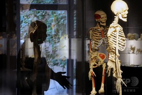 3Dプリントの人工骨、周囲の骨再生を促進 米研究 3Dプリントの人工骨、周囲の骨再生を促進 米研究
