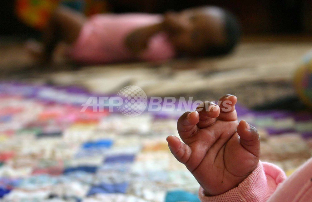 南アフリカ東部で先天異常児の出産急増 原因不明 写真1枚 国際ニュース Afpbb News