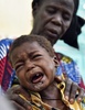 ニジェールのジンデルに設置されたスイスのNGO「サンティネル」の診療所で、壊疽性口内炎（水がん）の治療を受ける少年（2015年5月26日撮影）。(c)AFP/ISSOUF SANOGO