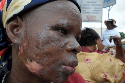 アフリカへの有毒廃棄物投棄、蘭企業が和解金支払いに合意