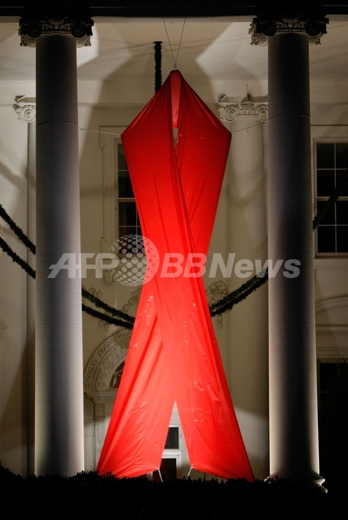 ラスベガスの病院、4万人がHIVか肝炎感染の可能性