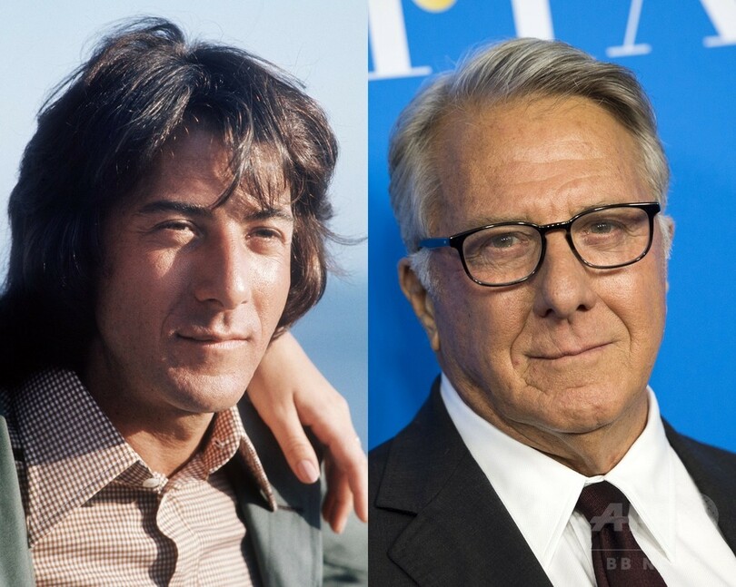 【写真特集】海外男性セレブのビフォーアフター