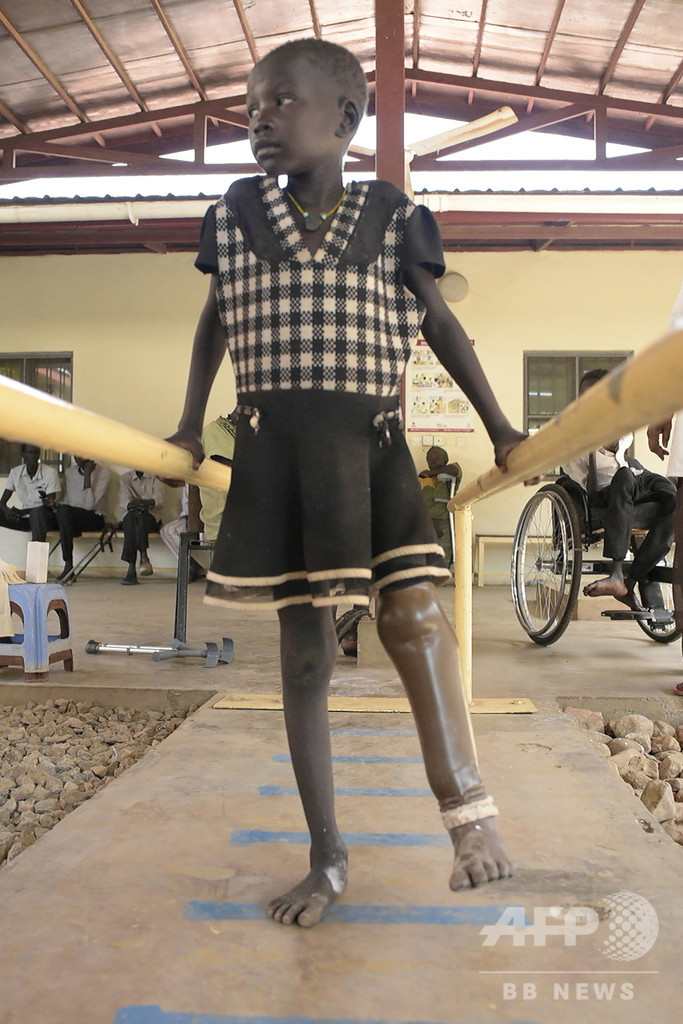 内戦で数万人が手足失い…全国から義肢求めて訪れる施設 南スーダン