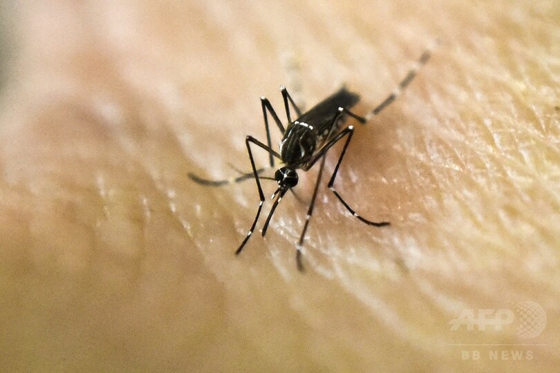 ジカ関連の小頭症、スペインで初確認