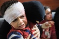 シリアの首都ダマスカス近郊の反体制派支配地区、東グータで、空爆後に治療施設で手当てを待つ人々（2018年3月7日撮影）。(c)AFP PHOTO / Abdullah HAMMAM