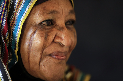 消えゆく風習、消えない顔の傷 スーダン